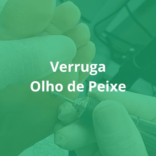 Capa verruga olho de peixe